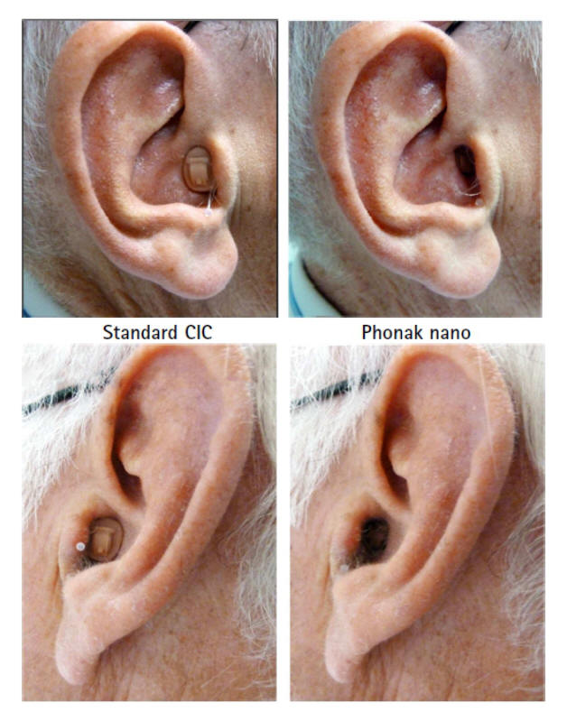 внутриушной слуховой аппарат вид на ухе