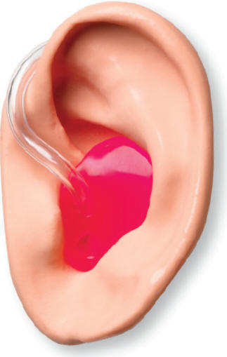 заушный слуховой аппарат с индивидуальным вкладышем